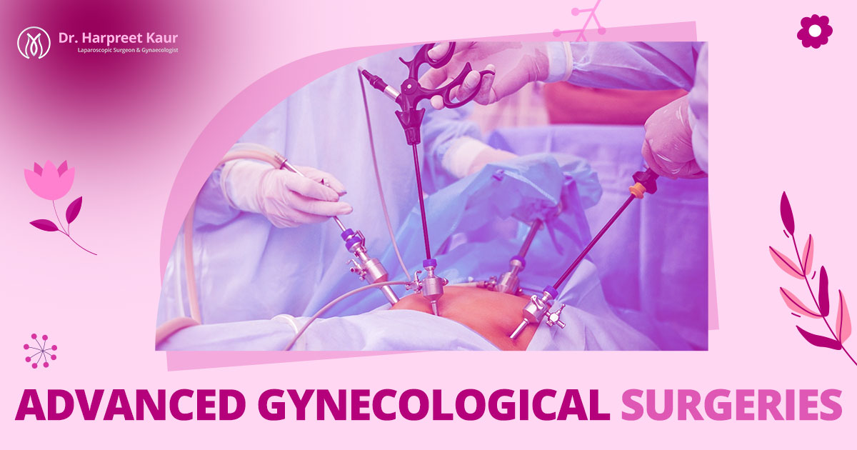 Advanced Gynecological Surgeries