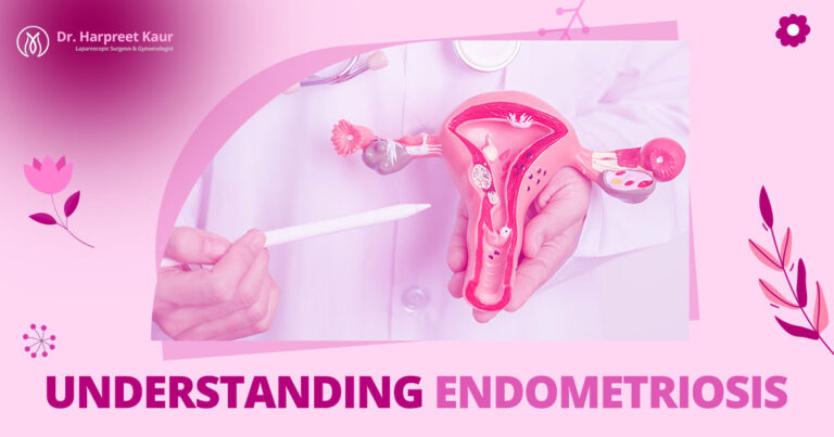 Understanding Endometriosis: Symptoms, Causes, and Treatment Options